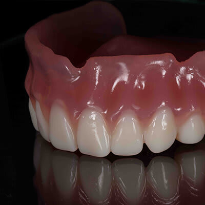 Golden Ceramic Dental Lab provides perfect smiles 40% faster with Carbon